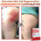 🌈MicroNeedle Botanic Skin Tag Removal Patch|Made in the USA