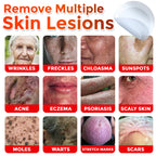 🌈MicroNeedle Botanic Skin Tag Removal Patch|Made in the USA
